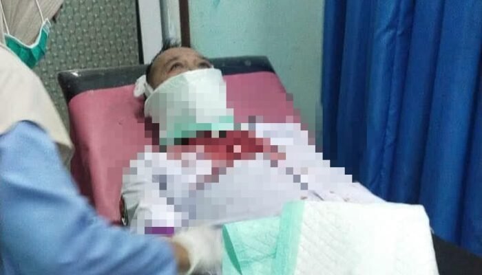 Bibir Pendeta Suryanto Luka Parah Kena Benang Layangan di Jalan Raya Kecurit