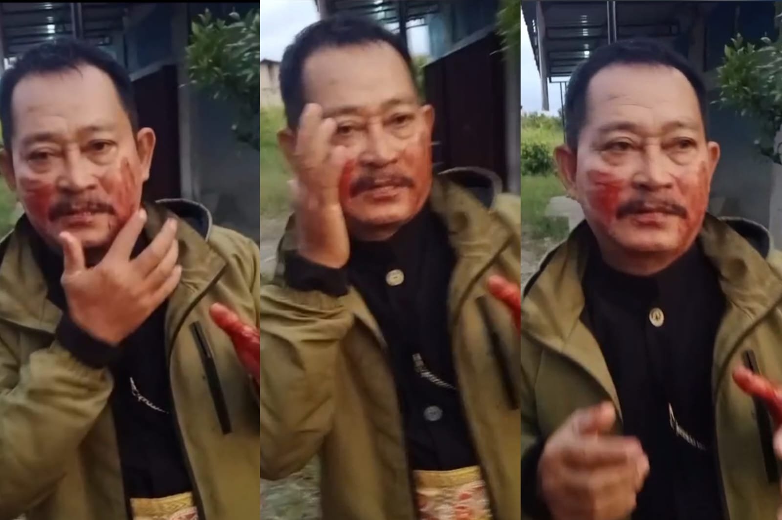 Ketua Forum Komunikasi Orang Bugis Mempawah, Mukmin terluka kena benang layangan.