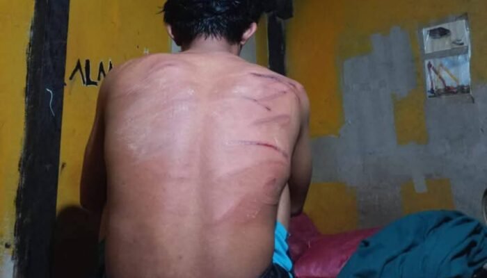 Dua Karyawan PT RIM Babak Belur Diduga Dianiaya di Mess Perusahaan